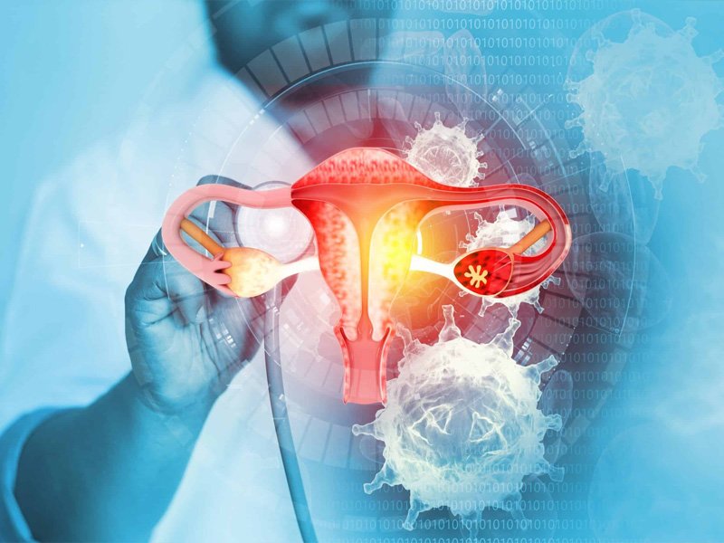 Cervical Cancer Screening (PAP Smear)