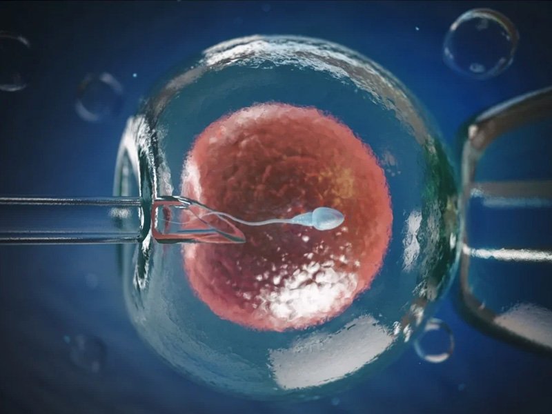 Infertility and IVF Support at Healing Sparshh UroGynae Clinic