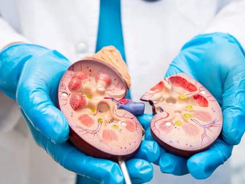 Kidney And Ureteric Problems