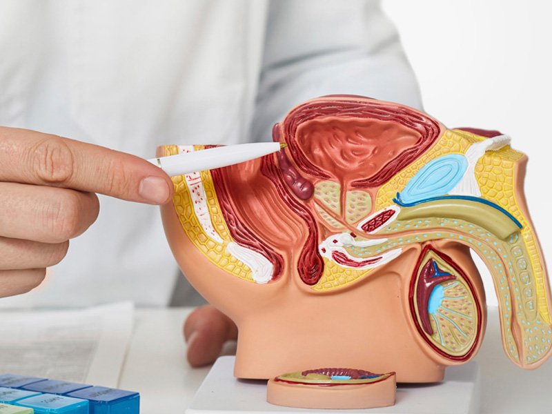 Prostate Enlargement Treatment